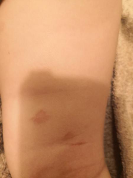 Čo to má moje dieťa na nohách?