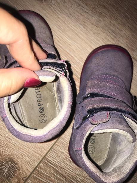 Topánky protetika, protetika,23