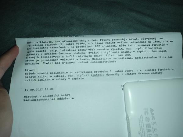 Súvisí nutnosť opakovaného RTG vyšetrenia s rakovinou?