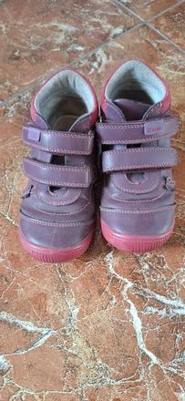 Prechodné topánky, protetika,26