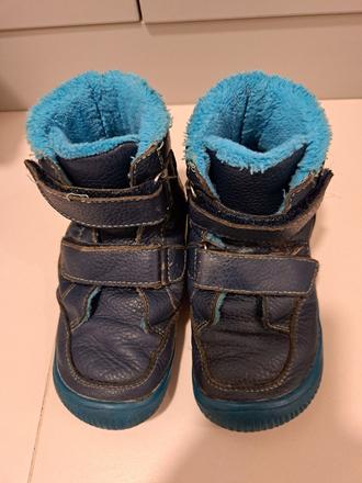 Protetika barefoot zimne, protetika,27