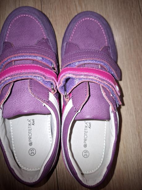 Topanky, protetika,35