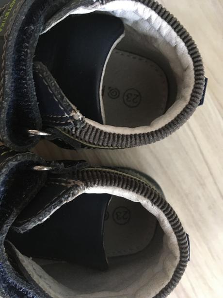 Topanocky protetika, protetika,23