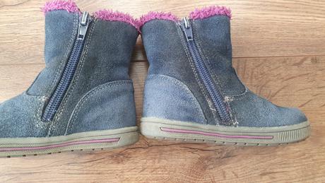 Čižmičky protetika v.21, protetika,21