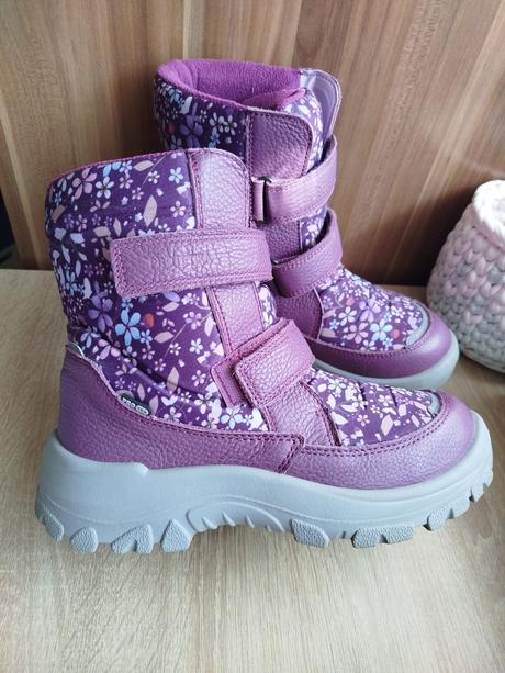 Protetika čižmy, protetika,38