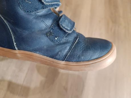 Zimne topanky protetika, protetika,30