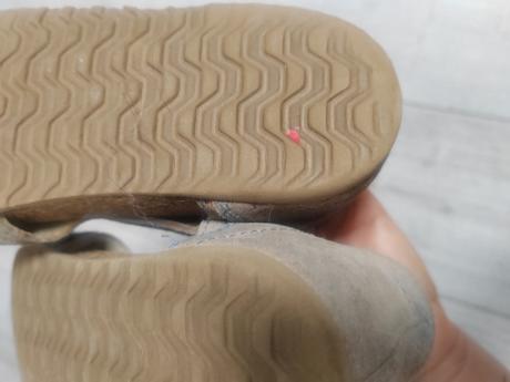 Papuce protetika, protetika,31