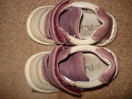 Ortopedické prechodné topánky protetika, protetika,21