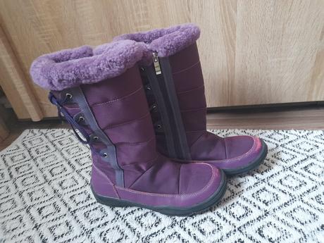 Cizmicky protetika, protetika,35