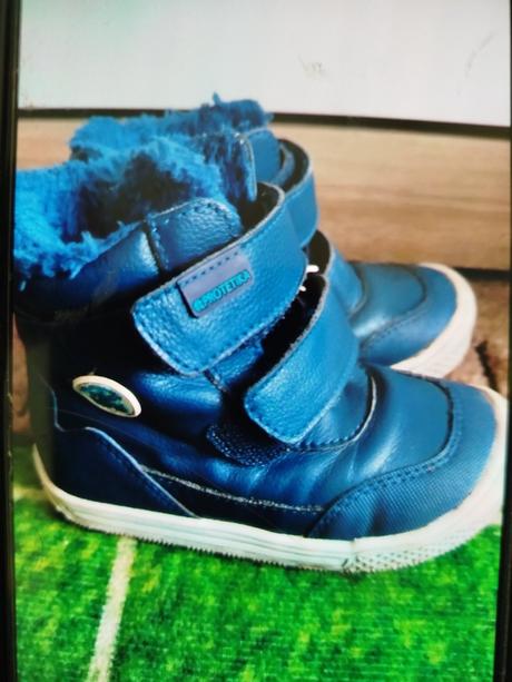 Topánočky protetika, protetika,23