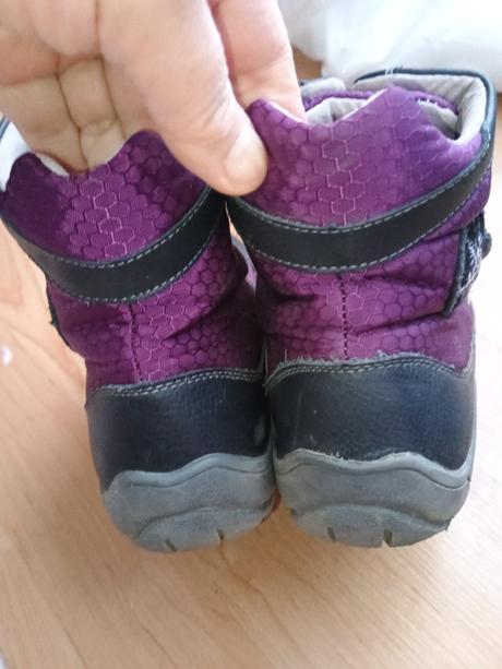 Čižmy protetika, protetika,34