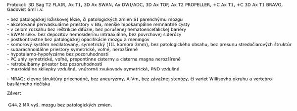 Sú výsledky MRI mozgu v poriadku?
