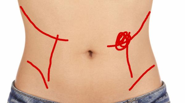 Dlhotrvajúce bolesti brucha a chrbta: Čo s tým robiť?