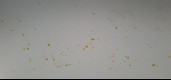 Ako odstrániť zažraté škvrny v kuchyni?