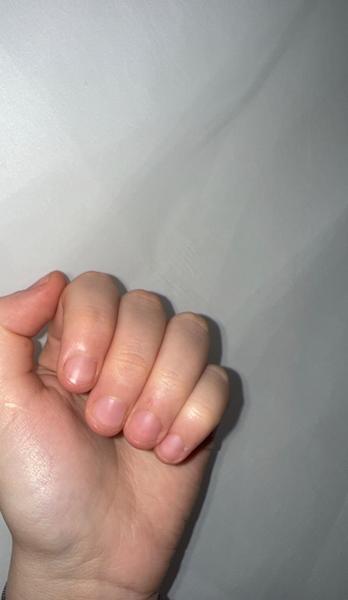 Ako podporiť rast slabých nechtov?