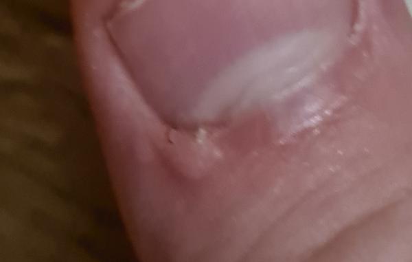 Čo je toto za výrastok?