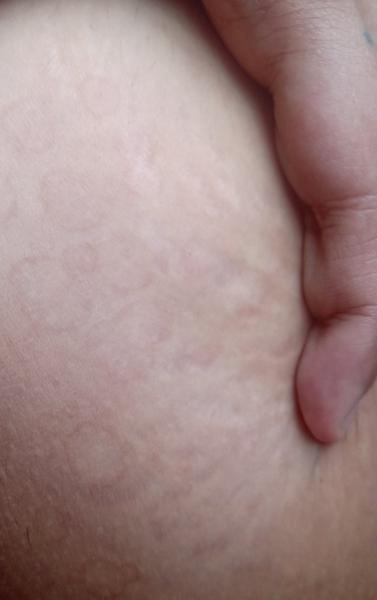 Aký je vhodný krém na kožné problémy?