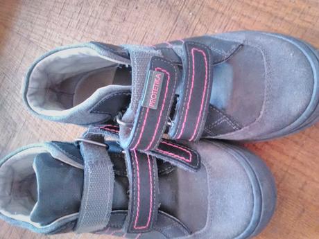 Topánky na prechod, protetika,33