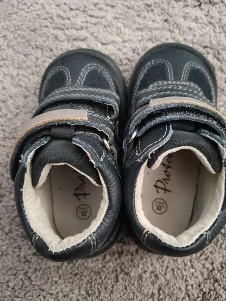 Topánočky protetika, protetika,20