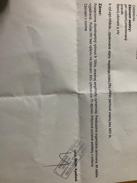 Ako porozumieť výsledkom EEG vyšetrenia?