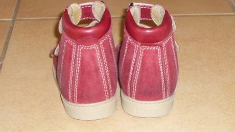 Sandálky protetika, protetika,24