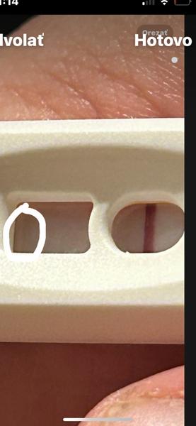 Je pozitívny tehotenský test dôvod na radosť?