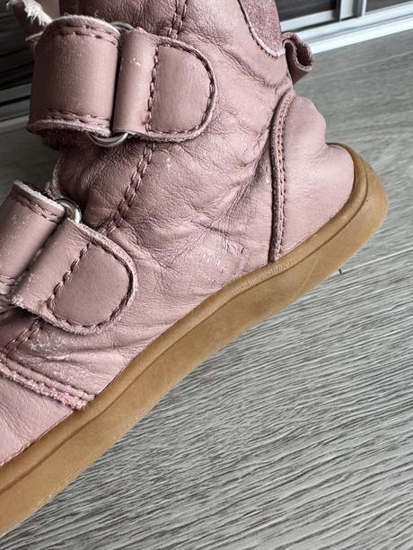 Zimne topanky protetika barefoot, protetika,29