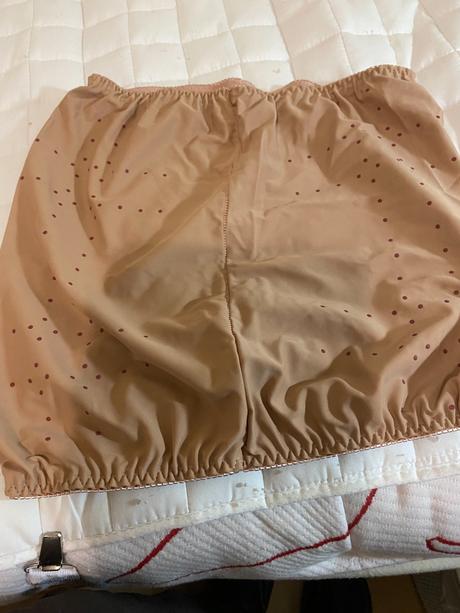 Pooperačný brušný, 