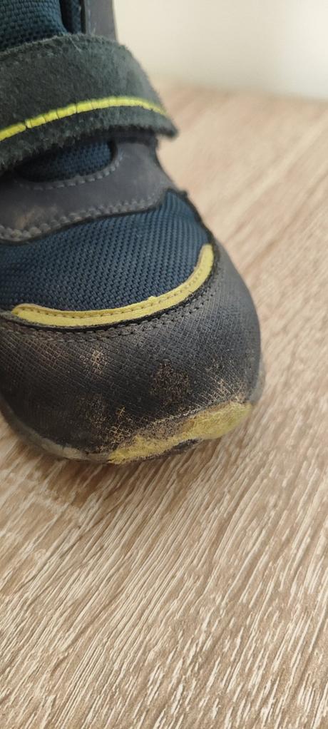 Protetika, protetika,27