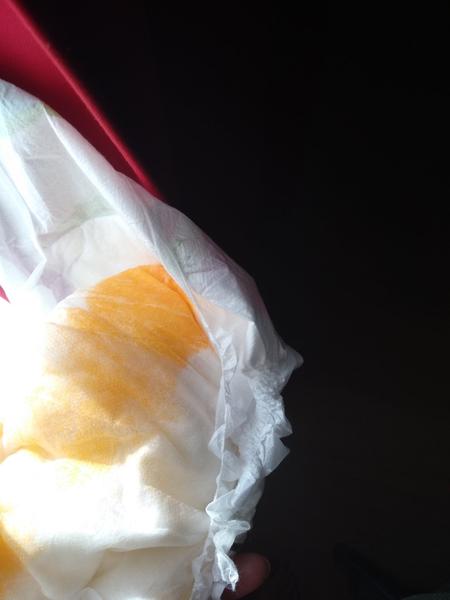 1,5 ročná dcéra má oranžovú tekutú hnačku. Ako jej môžem pomôcť?