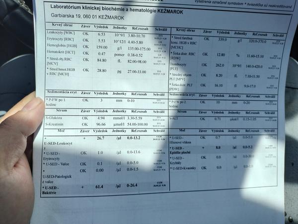 Sú moje výsledky dobré?