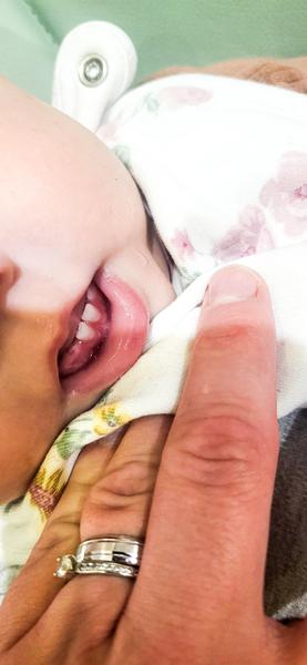 Ako zvládnuť prerezávanie zubu u bábätka?