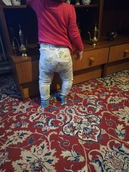 Krivá nožička 15 mesačného dieťaťa