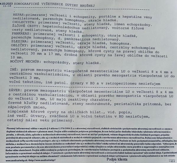 Ide na základe môjho nálezu o niečo závažné?