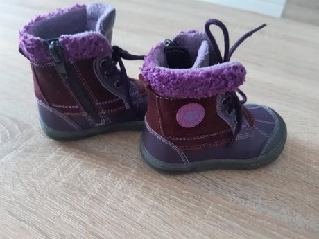 Protetika topánky - jar/jeseň, mierna zima, protetika,21