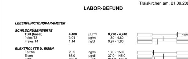 Čo znamená, keď mám zvýšenú TSH hodnotu?