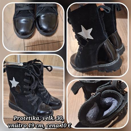 Topánky na predaj, protetika,30