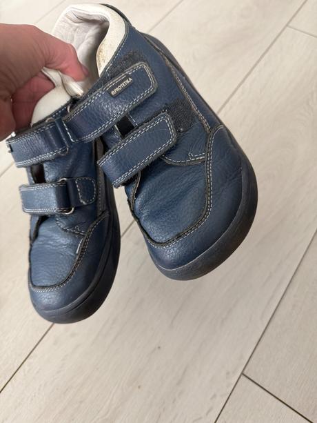 Protetika, protetika,33