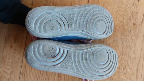 Protetika, protetika,34