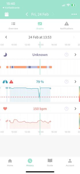 Môže saturácia rapídne klesnúť?
