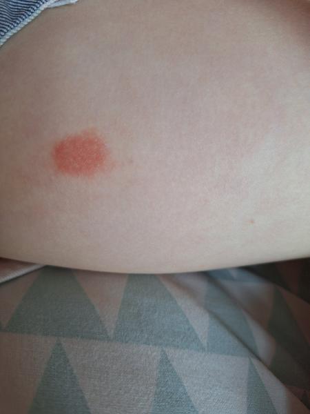 Čo má moja dcéra na nohe? Konzultácie a obavy