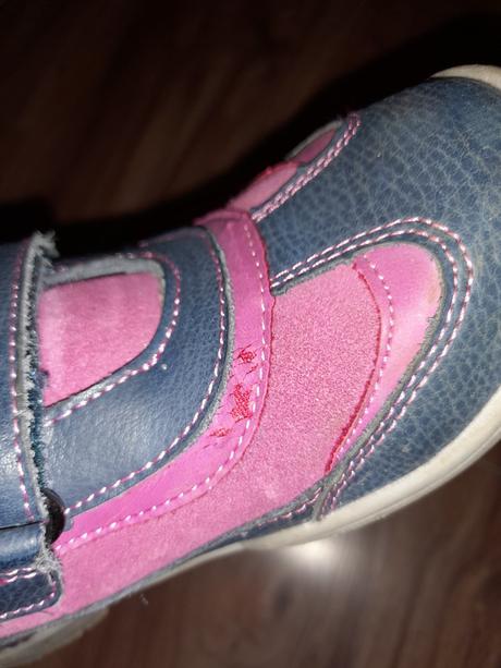 Čižmy sú, protetika,32