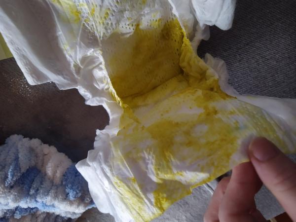 Štvormesačný syn má po zavedení mrkvy žltú stolicu. Čo mi odporúčate?