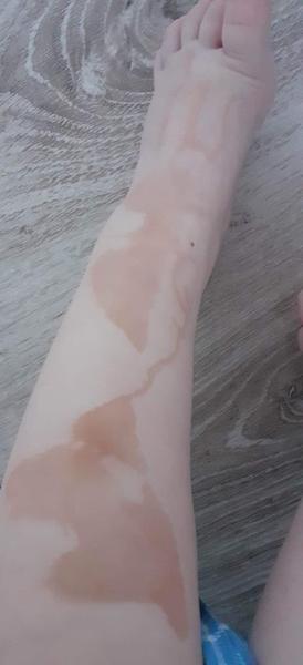 Čo to má syn na nohe?