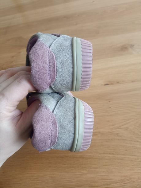 Prechodné topánky, protetika,26