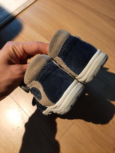 Ortopedicke papucky, protetika,24