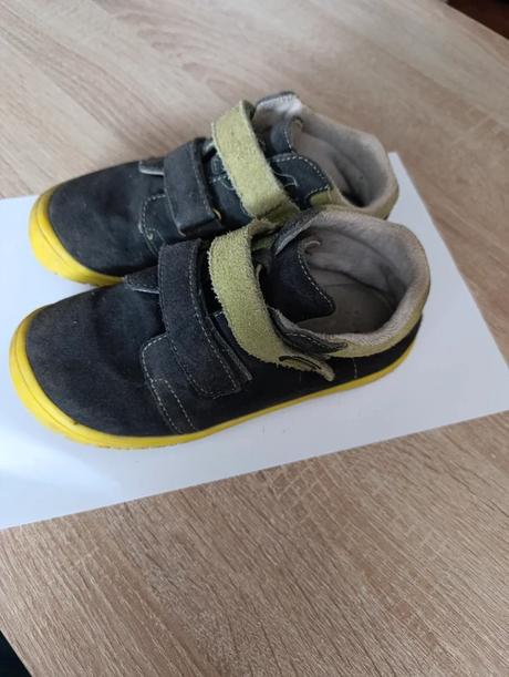 Barefoot protetika, protetika,31