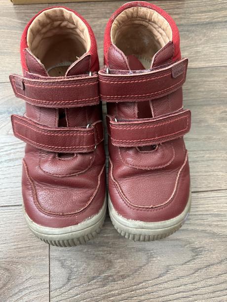 Protetika prechodné topánky, protetika,33