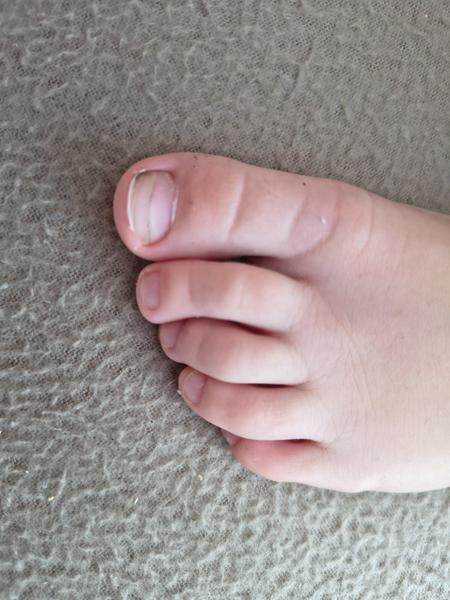 Nechtové problémy u detí