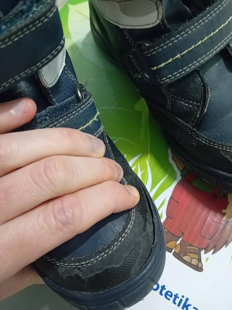 Protetika zimne topanocky, protetika,31